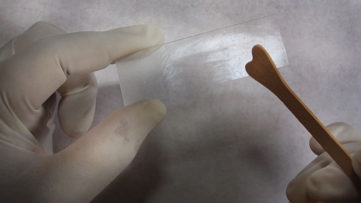 A Million Missed Notices: The Flaw in New Zealand's Cervical Screening System